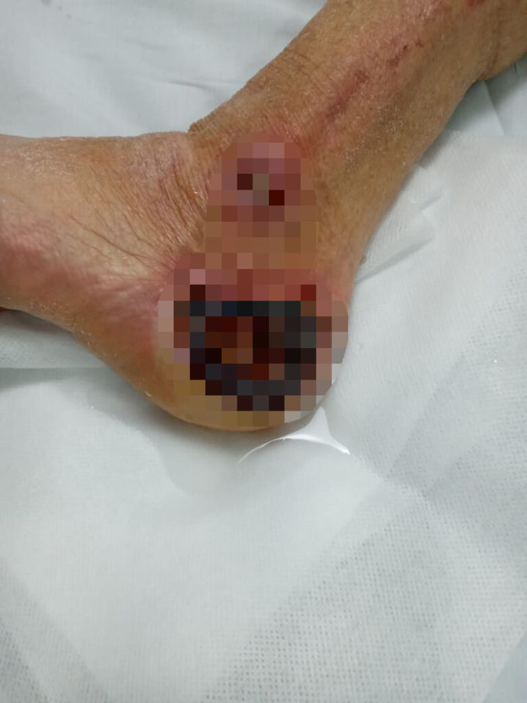 DRAMA, TRISTEZA E CAOS NA SAÚDE EM CANOAS