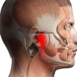 cirurgia ortognática 5