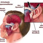 cirurgia ortognática 6