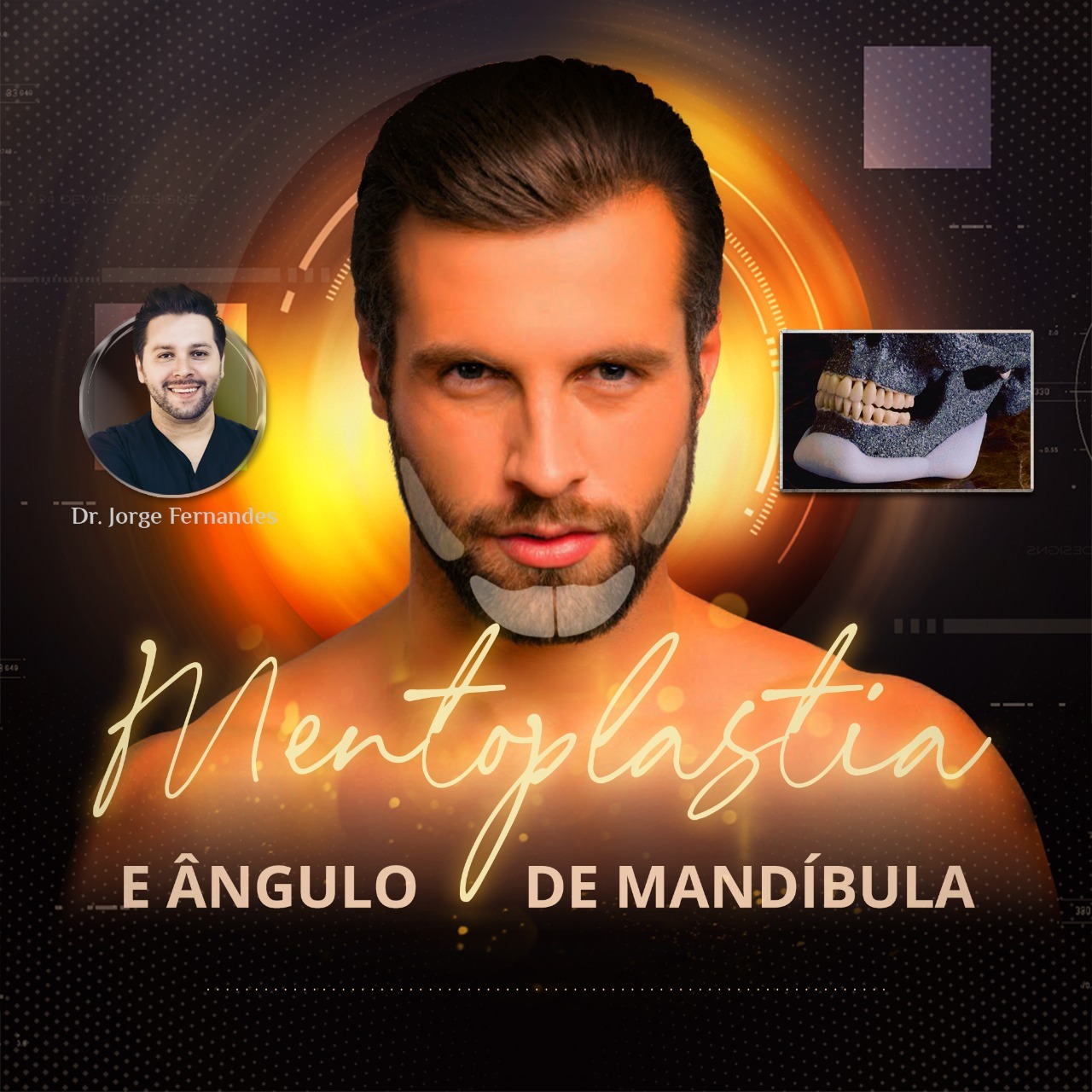 Próteses Faciais