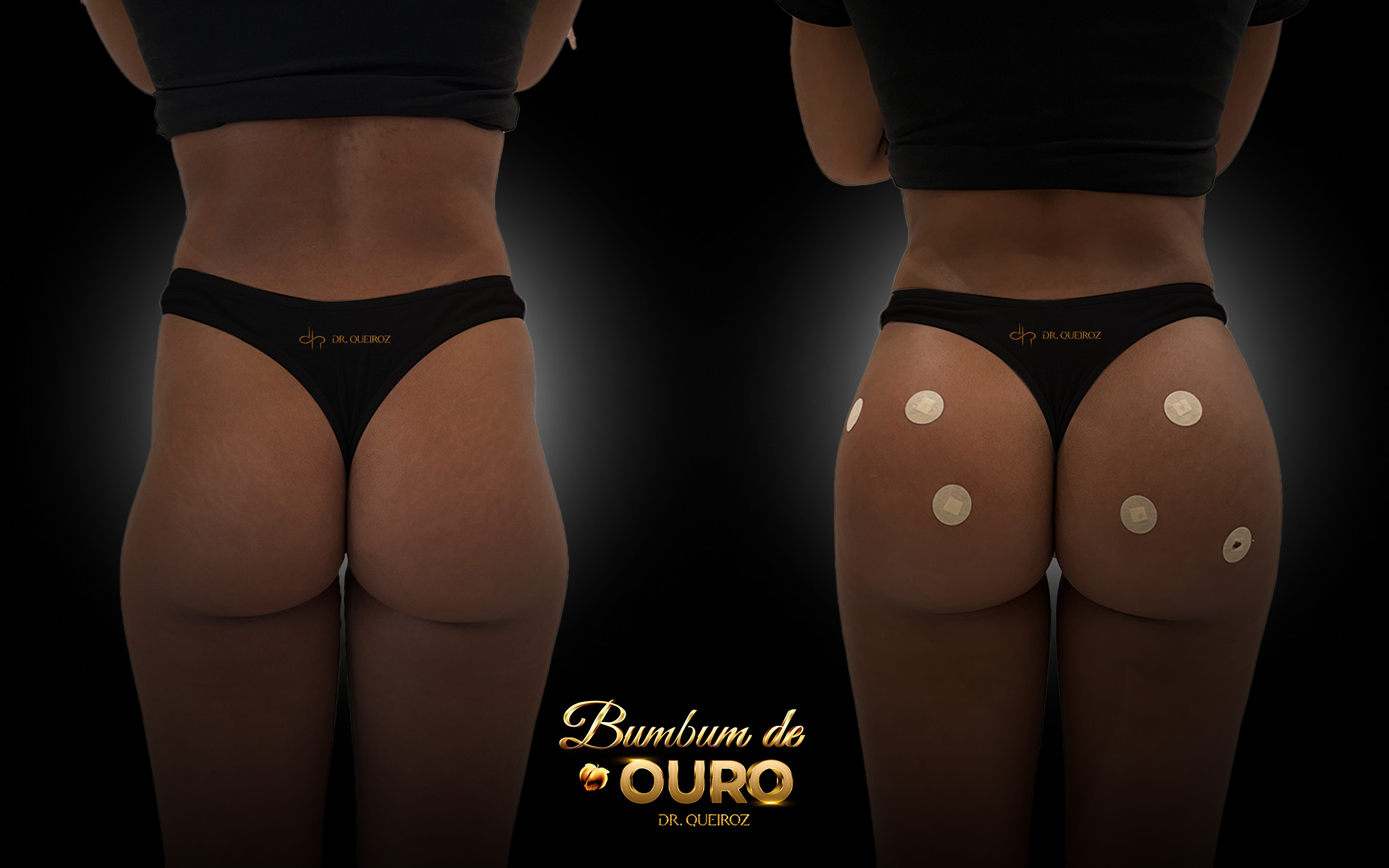 Diego Queiroz