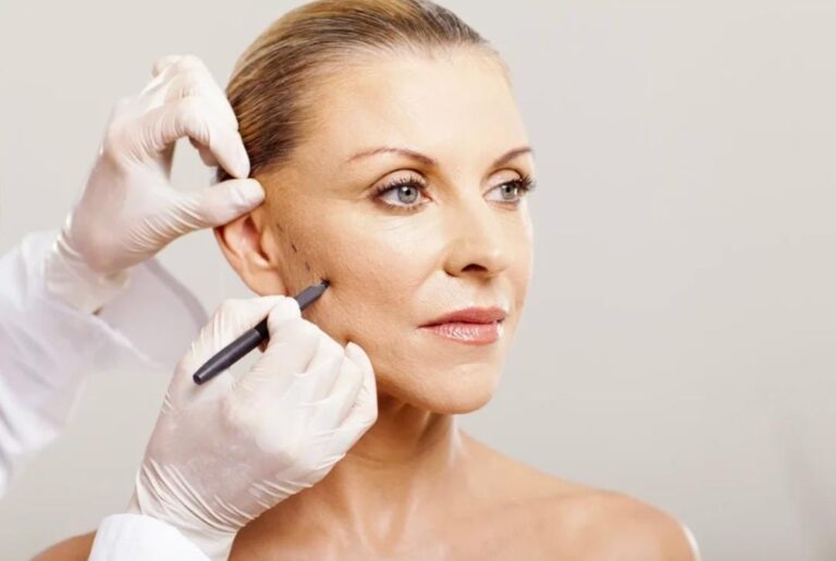 Facelift: A cirurgia que redefine rosto e restaura a juventude natural